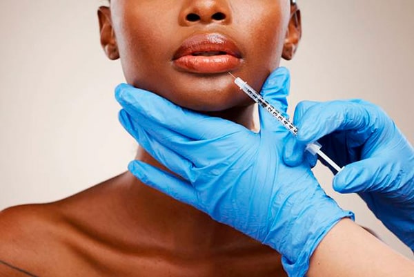 Dermal fillers