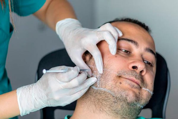 Masseter Botox