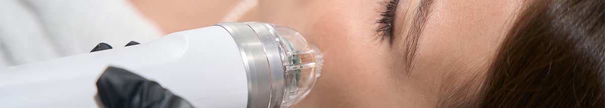 Microneedling and Dermaplaning