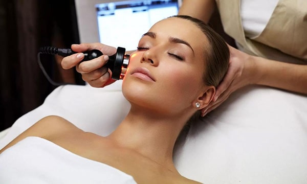 Close-up of the cheek showing a smoother, even-toned complexion after an IPL treatment for sun spots.
