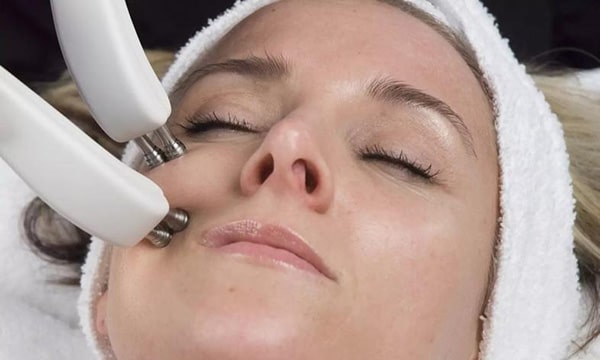 Close-up of a woman’s face showing lifted contours and glowing skin after a microcurrent facial treatment.