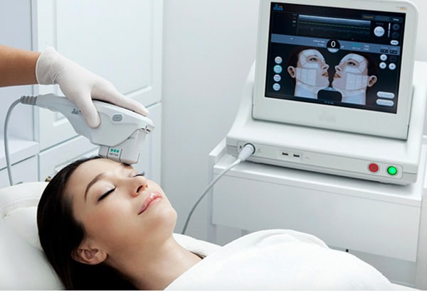 Close-up of the lower face and neck, showing firmer, lifted skin after an Ultherapy treatment.